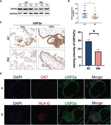 Decreased USP2a Expression Inhibits Trophoblast Invasion and Associates With Recurrent Miscarriage